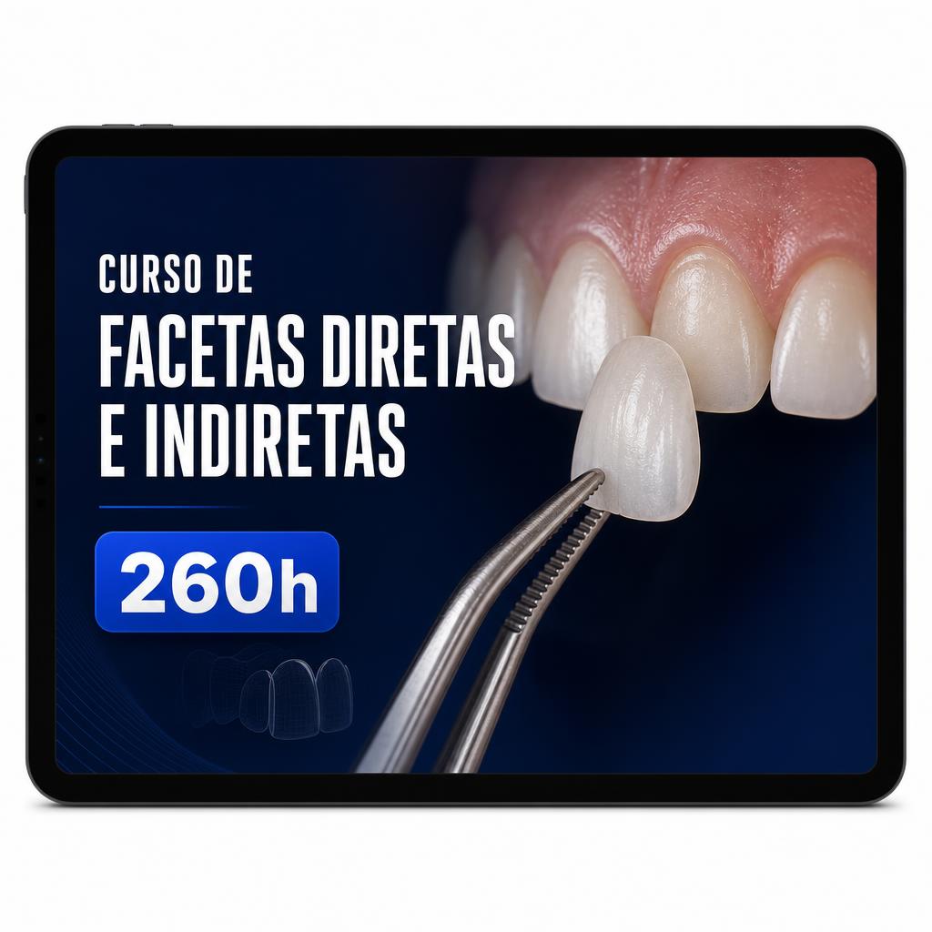 Curso de Facetas Diretas e Indiretas